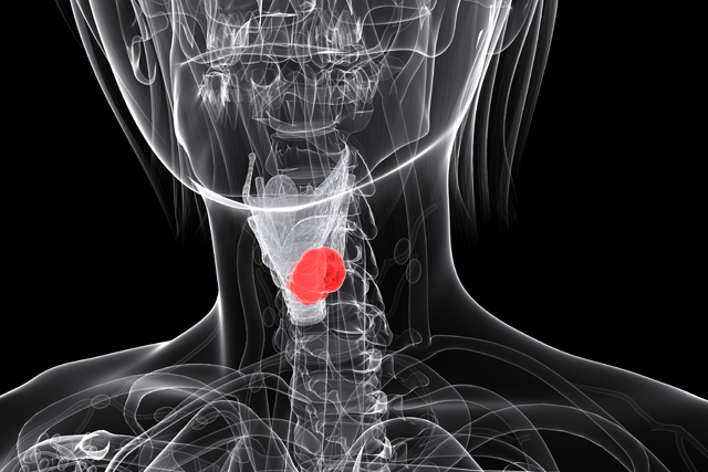 Head and Neck Cancer Treatment