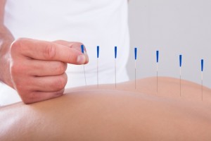 Acupuncture for Lung Cancer